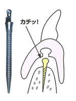 名古屋市 中区 歯科 歯医者 審美歯科